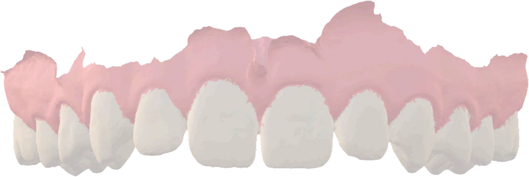 normal teeth